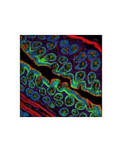 Cell Signaling Phospho-Beta-Catenin (Ser675) (D2f1) Xp Rabbit mAb