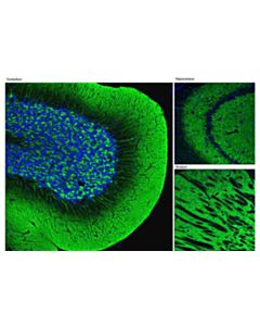 Cell Signaling Alpha-Synuclein (D37a6) Rabbit mAb