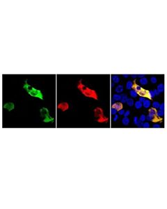 Cell Signaling Lbcpf1 (Strain Nd2006 ) (E8b1w) Rabbit mAb