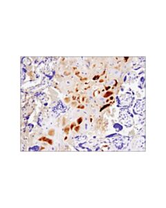 Cell Signaling LbCpf1/Cas12a (Strain ND2006 ) (E8B1W) Rabbit mAb 20 uL