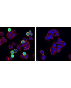 Cell Signaling Phospho-Stathmin (Ser38) (D19h10) Rabbit mAb