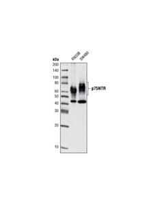 Cell Signaling P75ntr (D8a8) Rabbit mAb