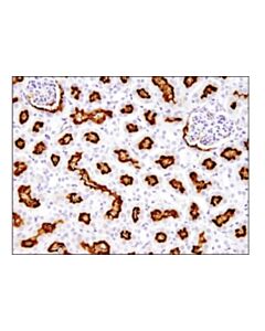 Cell Signaling Abcg2 (D5v2k) Xp Rabbit mAb