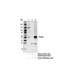 Cell Signaling Parkin (Prk8) Mouse mAb