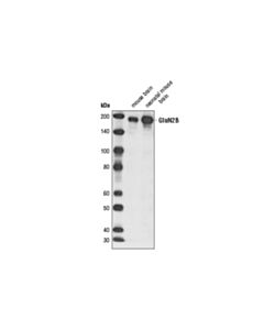 Cell Signaling NMDA Receptor 2B (GluN2B) (D15B3) Rabbit mAb 20 uL