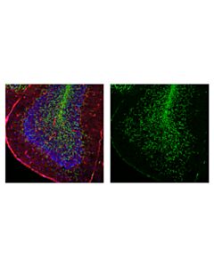 Cell Signaling Demyelinating Disease Targets Antibody Sampler Kit
