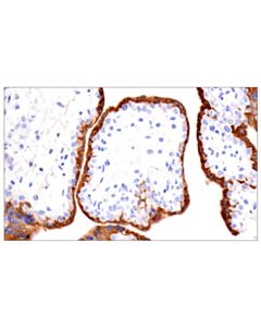 Cell Signaling KISS1 (E6H9S) Rabbit mAb 100 uL