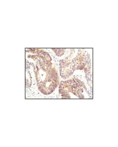 Cell Signaling Fas (C18c12) Rabbit mAb