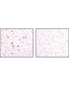 Cell Signaling Nnos (C12h1) Rabbit mAb