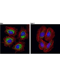 Cell Signaling Tom20 (D8t4n) Rabbit mAb