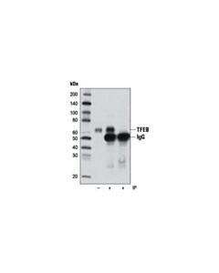 Cell Signaling Tfeb Antibody