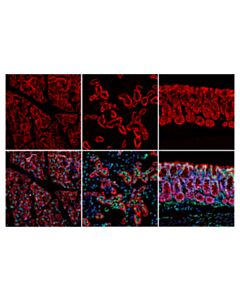 Cell Signaling Epcam (E8q1z) Rabbit mAb (Mouse Preferred)