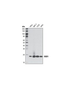 Cell Signaling Sod1 (71g8) Mouse mAb