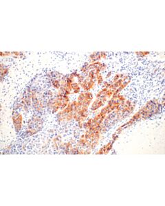 Cell Signaling Egf Receptor (D38b1) Xp Rabbit mAb