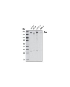 Cell Signaling Ron (1B5) Mouse mAb 20 uL