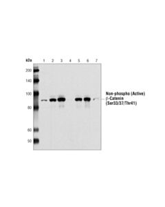 Cell Signaling Non-Phospho (Active) Beta-Catenin (Ser33/37/Thr41) Antibody