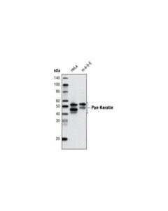 Cell Signaling Pan-Keratin (C11) Mouse mAb (Biotinylated)