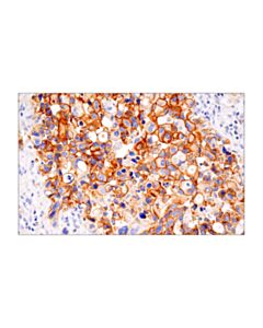 Cell Signaling Her2/Erbb2 (D8f12) Xp Rabbit mAb
