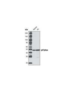 Cell Signaling P47phox (D21f6) Rabbit mAb