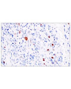 Cell Signaling Myogenin (E9A1S) Rabbit mAb 100 uL