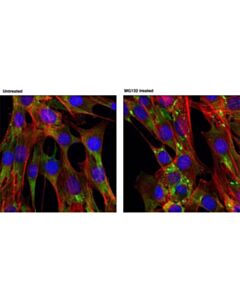 Cell Signaling Fmrp Antibody