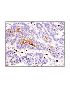 Cell Signaling S100a9 (D5o6o) Rabbit mAb (BSA And Azide Free)