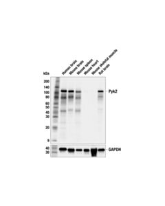 Cell Signaling Pyk2 (F3I2K) Rabbit mAb 100 uL