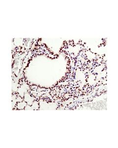 Cell Signaling Pyroptosis Antibody Sampler Kit