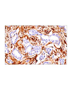 Cell Signaling Fth1 (D1d4) Rabbit mAb