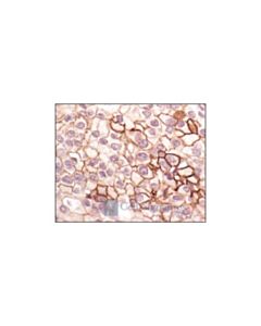 Cell Signaling Phospho-Egf Receptor (Tyr1148) Antibody