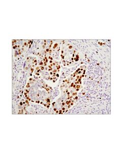 Cell Signaling Ki-67 (D2h10) Rabbit mAb (Ihc Specific) (BSA And Azide Free)