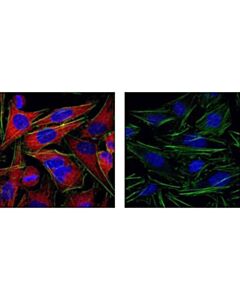 Cell Signaling Anti-Rabbit Igg (H+L), F(Ab) 2 Fragment (Alexa Fluor 555 Conjugate)