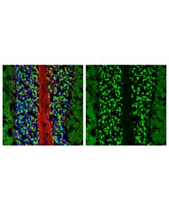 Cell Signaling Syngr3 (E2r8r) Rabbit mAb