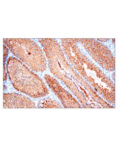 Cell Signaling Ly6k (E4k8y) Xp Rabbit mAb