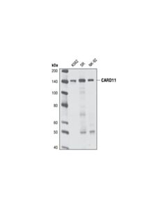 Cell Signaling Card11 (1d12) Rabbit mAb
