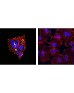 Cell Signaling Mrp2/Abcc2 (R260) Antibody