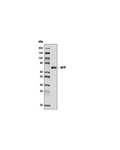 Cell Signaling Afp (D12c1) Rabbit mAb