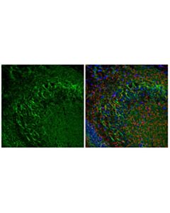 Cell Signaling Vgat Antibody