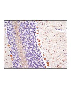 Cell Signaling Beta3-Tubulin (Tu-20) Mouse mAb