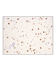 Cell Signaling Chd5 (D2f9q) Rabbit mAb