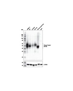 Cell Signaling Tissue Factor/Cd142 (E2l3b) Rabbit mAb (Mouse Specific)