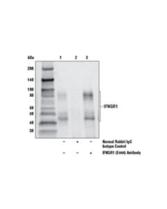 Cell Signaling Ifn-Gamma Signaling Pathway Antibody Sampler Kit
