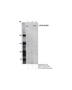 Cell Signaling Set1b (D1u5d) Rabbit mAb
