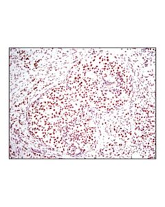 Cell Signaling Histone H3 (D1h2) Xp<Lt/>Sup&Gt;®<Lt/>/Sup&Gt; Rabbit mAb