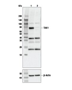 Cell Signaling Tak1 Antibody