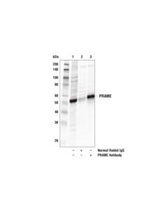 Cell Signaling Prame Antibody