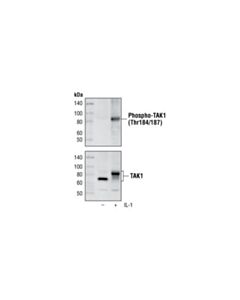 Cell Signaling Phospho-Tak1 (Thr184/187) (90c7) Rabbit mAb