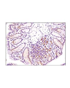 Cell Signaling Phospho-P38 Mapk (Thr180/Tyr182) (D3f9) Xp Rabbit mAb