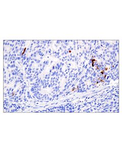 Cell Signaling S100a7 (E7x2c) Rabbit mAb