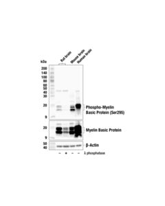 Cell Signaling Phospho-Myelin Basic Protein (Ser295) Antibody